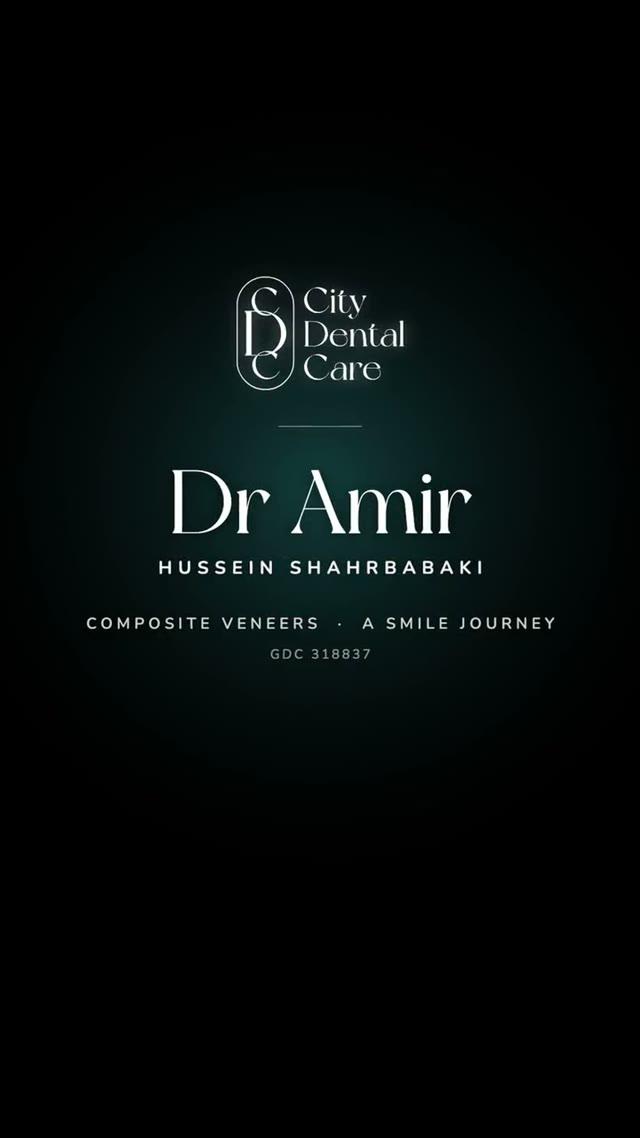 Composite veneers with Dr. Amir, from pre-op to polished