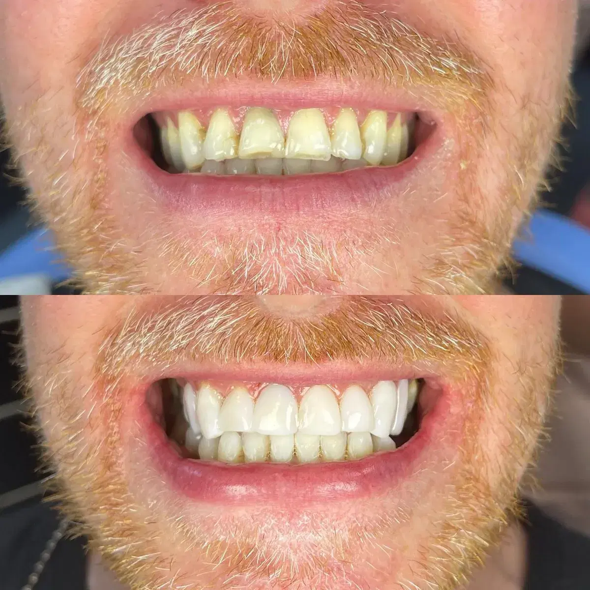 Inside a treatment room at City Dental Care on Earl Grey Street, Edinburgh